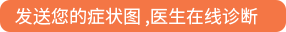 发送您的症状图 ,医生在线诊断